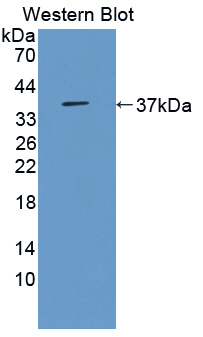 Polyclonal Antibody to 3-Mercaptopyruvate Sulfurtransferase (MST)