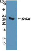 Polyclonal Antibody to Quinoid Dihydropteridine Reductase (QDPR)
