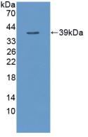 Polyclonal Antibody to Tumor Necrosis Factor Alpha Induced Protein 3 (TNFaIP3)