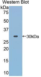 Polyclonal Antibody to Toll Interacting Protein (TOLLIP)