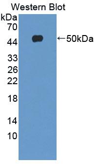 Polyclonal Antibody to Src Kinase Associated Phosphoprotein 1 (SKAP1)