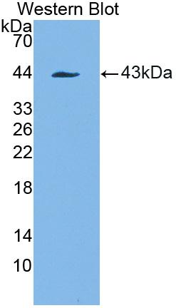 Polyclonal Antibody to Platelet Derived Growth Factor Receptor Like Protein (PDGFRL)