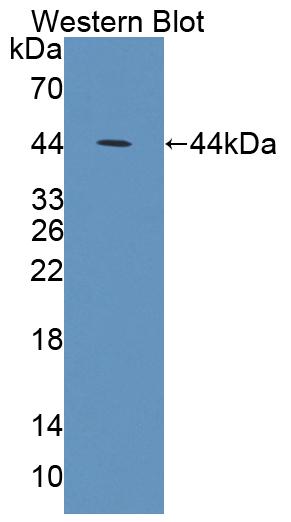 Polyclonal Antibody to Gamma-Aminobutyric Acid B Receptor 1 (gABBR1)