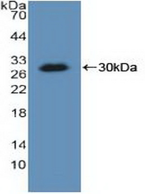 Polyclonal Antibody to Lysyl tRNA Synthetase (KARS)