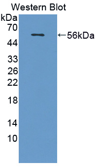 Polyclonal Antibody to X-Ray Repair Cross Complementing 5 (XRCC5)