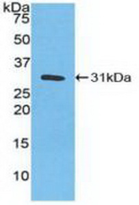 Polyclonal Antibody to Carbonic Anhydrase III, Muscle Specific (CA3)