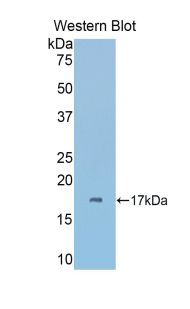 Polyclonal Antibody to Carbonic Anhydrase VI (CA6)