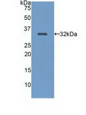 Polyclonal Antibody to Low Density Lipoprotein Receptor Related Protein 5 (LRP5)