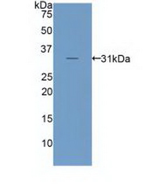 Polyclonal Antibody to Low Density Lipoprotein Receptor Related Protein 6 (LRP6)