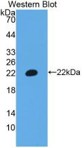 Polyclonal Antibody to T-Cell Surface Glycoprotein CD3 Epsilon (CD3e)