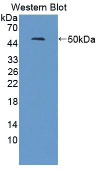 Polyclonal Antibody to Liver X Receptor Beta (LXRb)