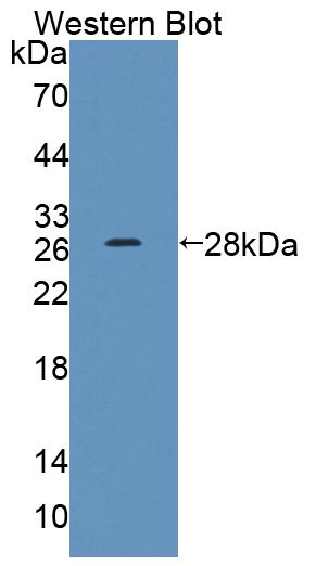 Polyclonal Antibody to Cholinergic Receptor, Nicotinic, Alpha 3 (CHRNa3)