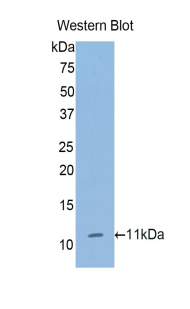 Polyclonal Antibody to Collagen Type II Alpha 1 (COL2a1)