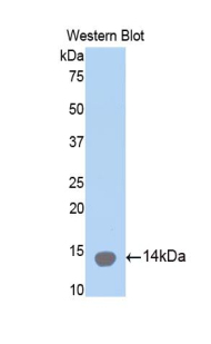 Polyclonal Antibody to Collagen Type II Alpha 1 (COL2a1)