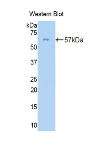 Polyclonal Antibody to Collagen Type III Alpha 1 (COL3a1)