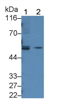 Polyclonal Antibody to Sjogren Syndrome Antigen A1 (SSA1)