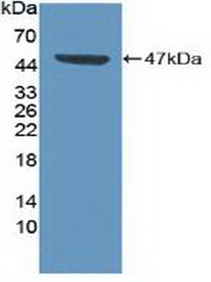 Polyclonal Antibody to Cyclin Dependent Kinase 8 (CDK8)