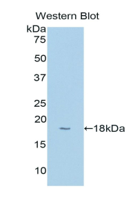 Polyclonal Antibody to Cytochrome P450 1B1 (CYP1B1)