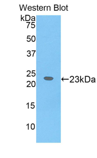Polyclonal Antibody to Interleukin 17 Receptor B (IL17RB)