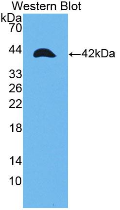 Polyclonal Antibody to Tropomyosin 2 Beta (TPM2)