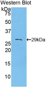 Polyclonal Antibody to Pyruvate Dehydrogenase Kinase Isozyme 2 (PDK2)