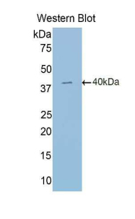 Polyclonal Antibody to Hypoxia Inducible Factor 2 Alpha (HIF2a)
