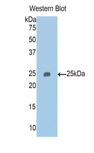 Polyclonal Antibody to Pappalysin 2 (PAPPA2)