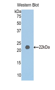 Polyclonal Antibody to Pappalysin 2 (PAPPA2)