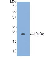 Polyclonal Antibody to Heat Shock Protein Beta 3 (HSPb3)