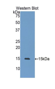 Polyclonal Antibody to Heat Shock 105kDa/110kDa Protein 1 (HSPH1)
