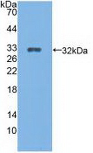 Polyclonal Antibody to Cytochrome P450 27B1 (CYP27B1)