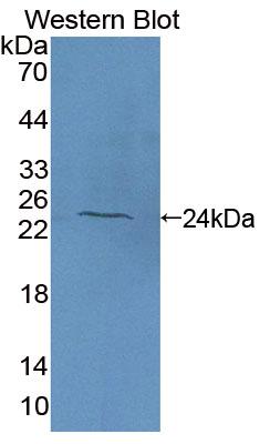 Polyclonal Antibody to Cytochrome P450 5A1 (CYP5A1)