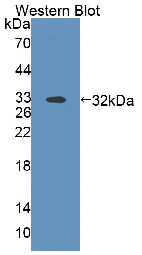 Polyclonal Antibody to ATP Binding Cassette Transporter B9 (ABCB9)