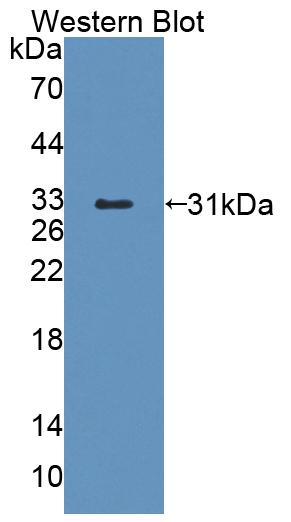 Polyclonal Antibody to ATP Binding Cassette Transporter D4 (ABCD4)