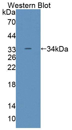 Polyclonal Antibody to ATP Binding Cassette Transporter G8 (ABCG8)