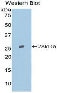 Polyclonal Antibody to Topoisomerase II Beta (TOP2b)