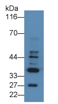 Polyclonal Antibody to Basic Salivary Proline Rich Protein 2 (PRB2)
