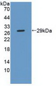 Polyclonal Antibody to Phospholipase C Gamma 2, Phosphatidylinositol Specific (PLCg2)
