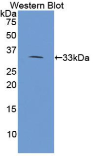 Polyclonal Antibody to Phospholipase A2 Receptor 1 (PLA2R1)