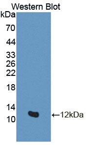Polyclonal Antibody to General Transcription Factor IIH, Polypeptide 5 (GTF2H5)