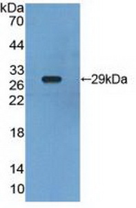 Polyclonal Antibody to Retinoid X Receptor Gamma (RXRg)