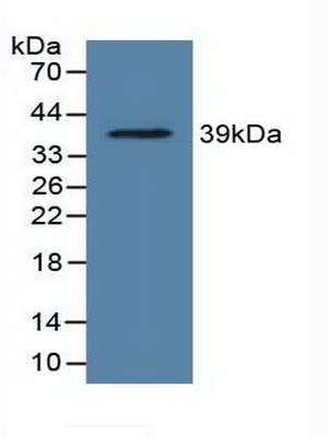 Polyclonal Antibody to Lactate Dehydrogenase C (LDHC)