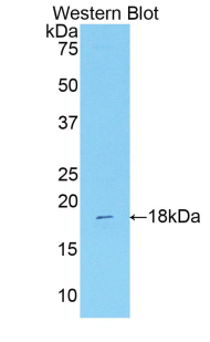 Polyclonal Antibody to Indoleamine-2,3-Dioxygenase 2 (IDO2)