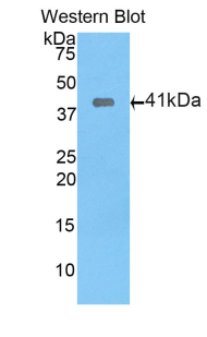 Polyclonal Antibody to WAP Four Disulfide Core Domain Protein 5 (WFDC5)