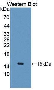 Polyclonal Antibody to Ubiquitin Associated Protein 2 (UBAP2)