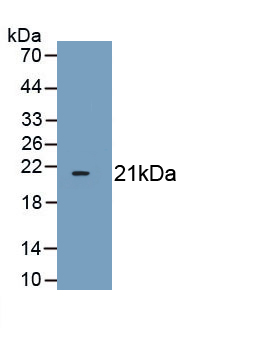 Polyclonal Antibody to Cyclin Dependent Kinase Inhibitor 1A (CDKN1A)