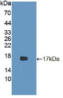 Polyclonal Antibody to Cyclin Dependent Kinase Inhibitor 2B (CDKN2B)