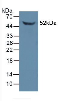 Polyclonal Antibody to FK506 Binding Protein 5 (FKBP5)