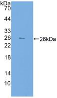 Polyclonal Antibody to FK506 Binding Protein 7 (FKBP7)