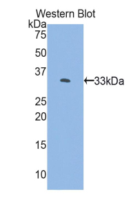 Polyclonal Antibody to FK506 Binding Protein 10 (FKBP10)